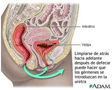 Alivio de la cistitis con el uso del aloe o sábila