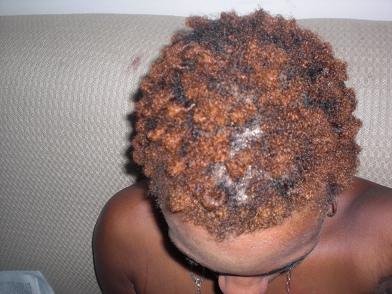 [teehair.jpg]