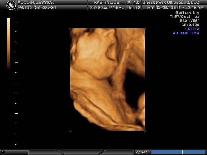 3d ultrasounds at 30 weeks 3d ultrasounds at 30 weeks