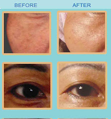 100% Superior Oxygen  Face Treatment