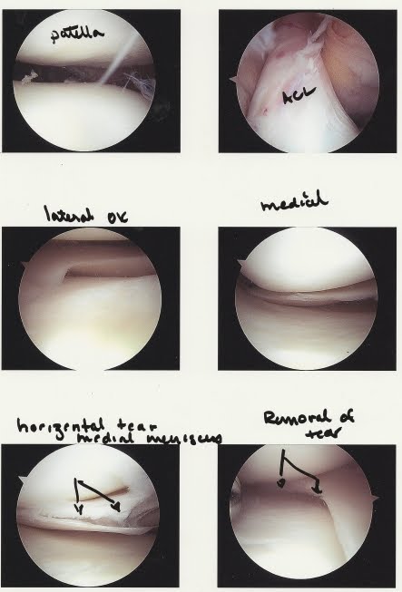 [Knee+Surgery.jpg]