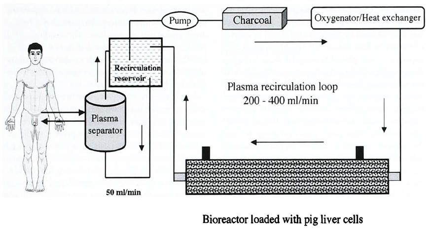 Artificial Liver Biological Extracorporeal Liver Assist Devices A
