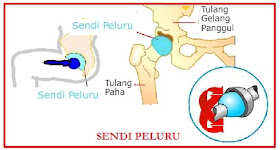 gel articular pentru tratament cum să anesteziați artroza articulației umărului