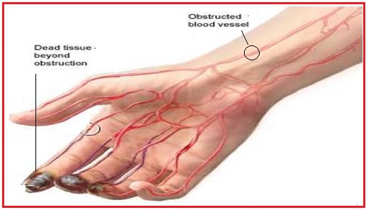 arteries and veins diagram. hot heart Cat+arteries+diagram