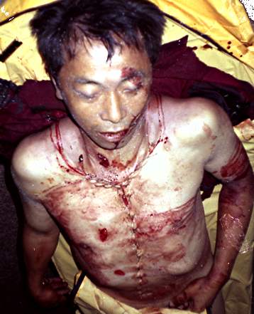 [è¢«å®³äººç…§ç‰‡2.jpg]