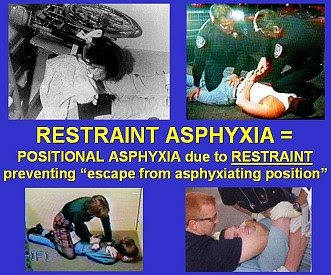 restraint asphyxia prone ppt positional killer silent miller 2004 slide