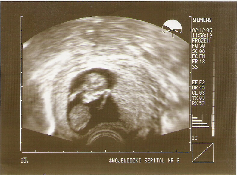 [scan.jpg]