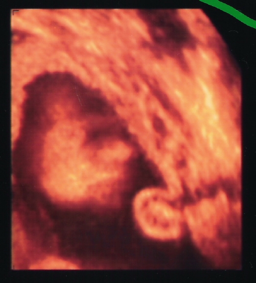 [Scan3d_3.JPG]