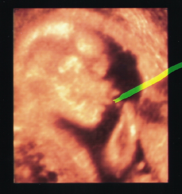 [Scan3d_2.JPG]