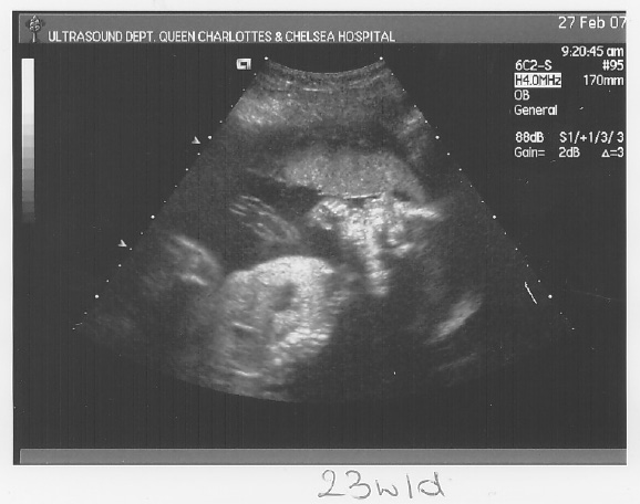 [scan3_4.jpg]