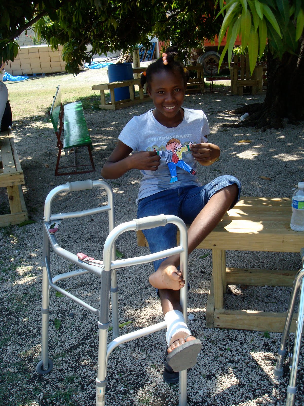 Physical Therapy Haiti Relief Starting Therapy