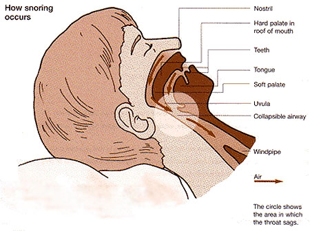why uvula snore snoring soft palate causes throat curious too
