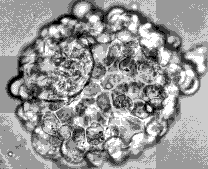 [Human-blastocyst+a.gif]