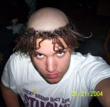 [bald-monk-hair.jpg]
