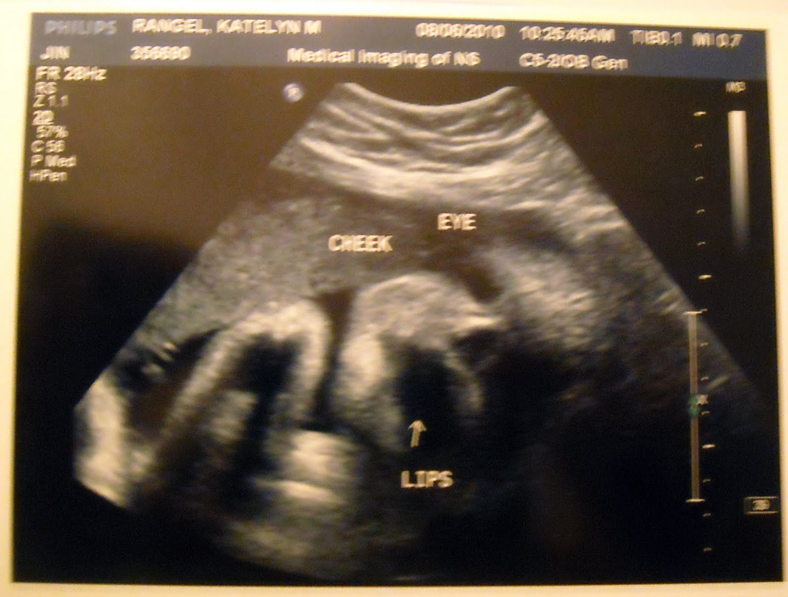 The Rangel's 36 Week Ultrasound