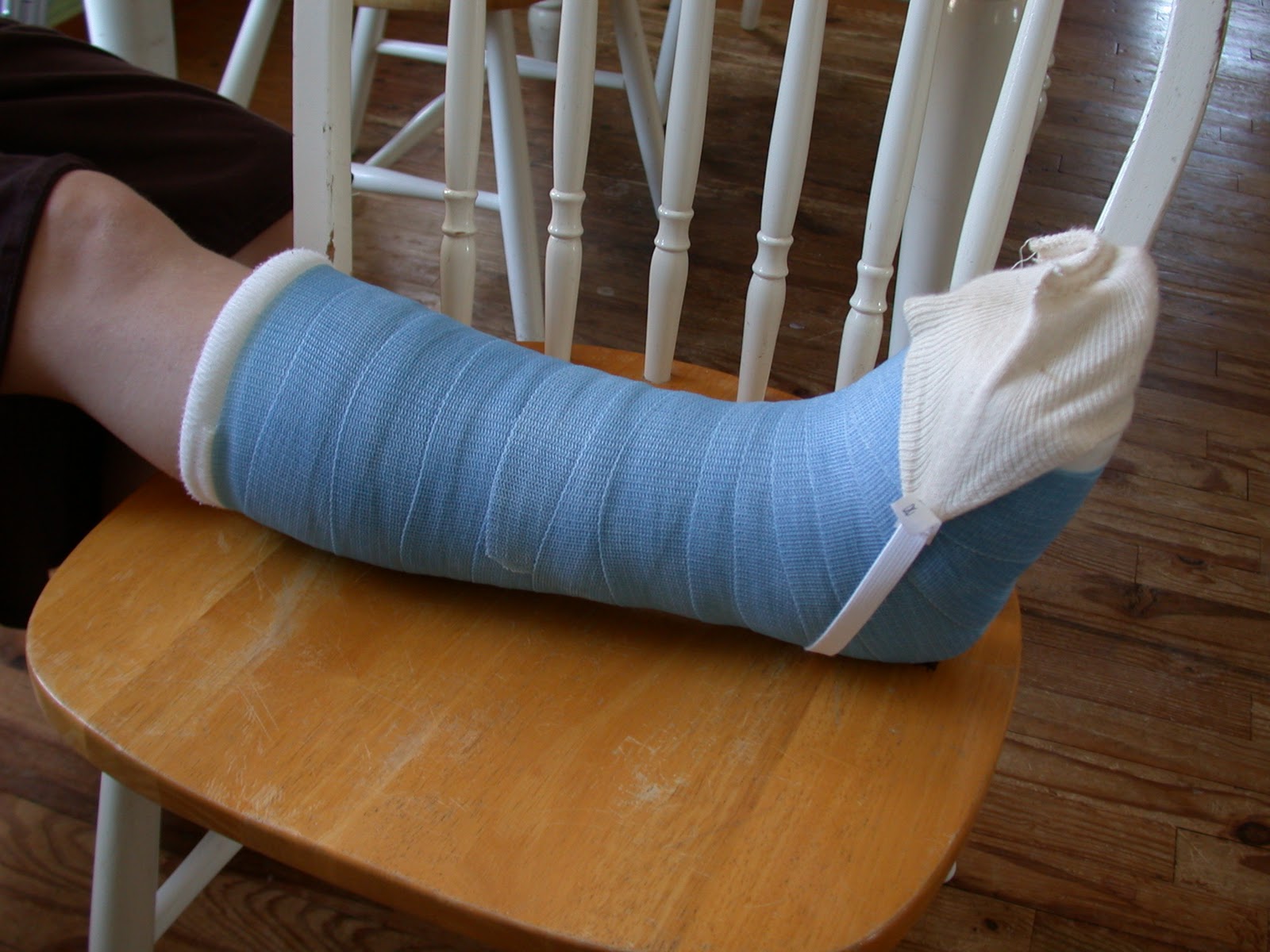 Rurification Robin Edmundson Project A boot for a cast