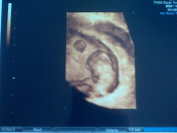 9 Week U/S