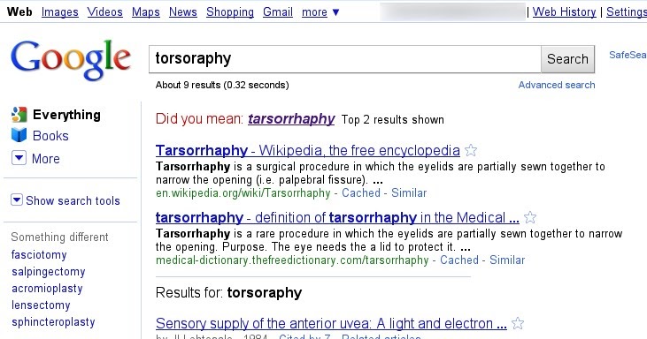 Google bing сообщить. Воровали в Майкрософт. Tarsorrhaphy meaning. Поисковая система бинг плюсы и минусы.