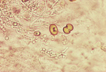 LAB PATOLOGI KLINIK: Urinalysis (sedimen)
