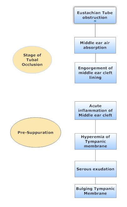 Medicine Life Acute Otitis Media Which Is The Most Important