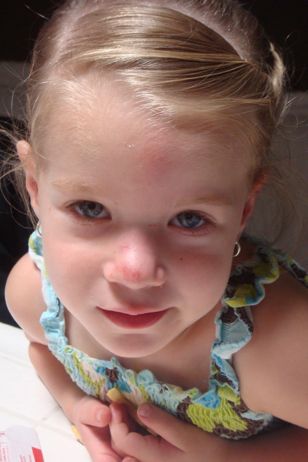 Bodacious Bingham Bunch Kadies first broken nose