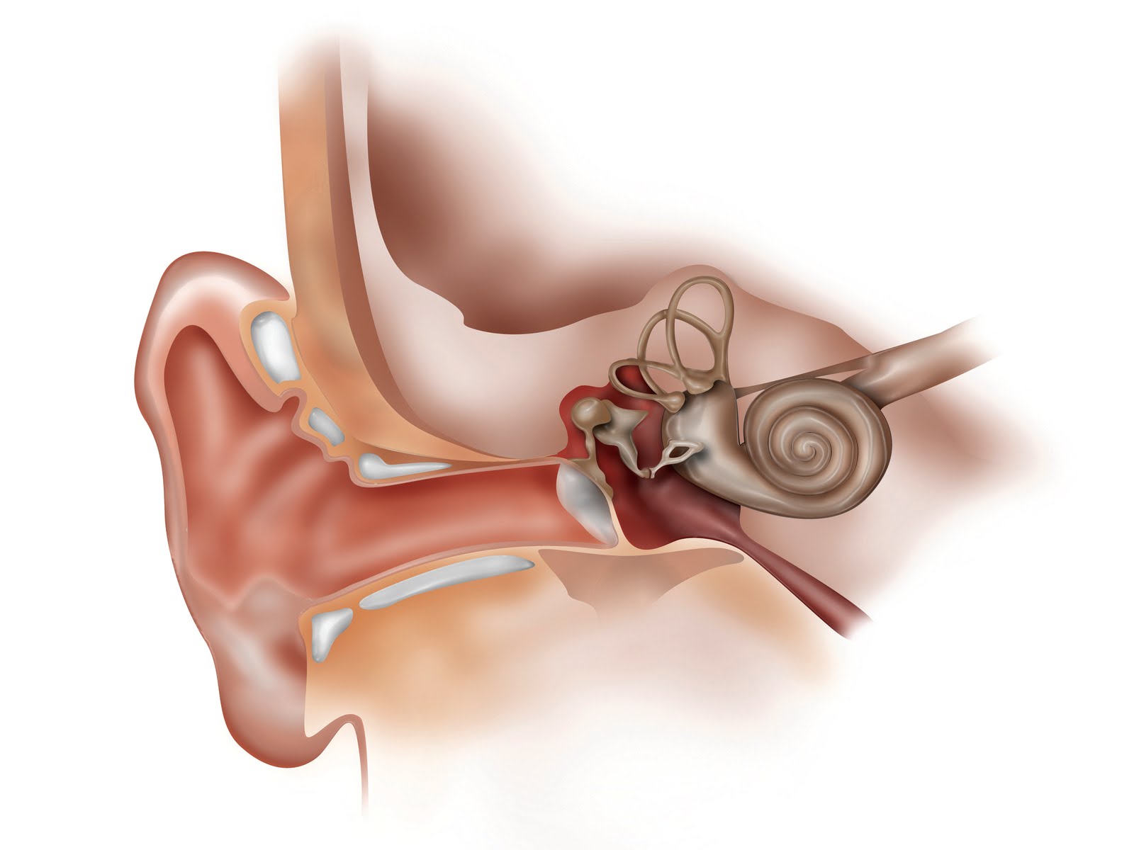 Шум среднего уха. Перилимфатическая фистула. Кохлеарный отосклероз. Отосклероз уха операция.
