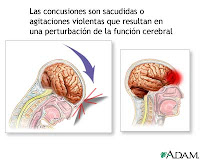 USMP-Medicina Humana- KeAn: Traumatismo craneal