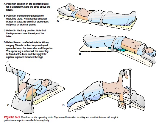 Perioperative Nursing: PREVENTING INTRAOPERATIVE POSITIONING INJURY