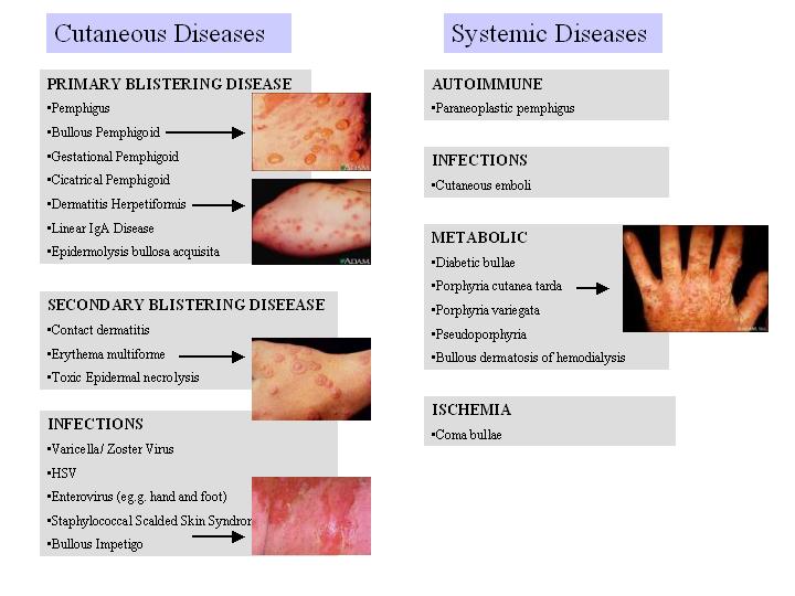 [bullous+skin+disease.jpg]