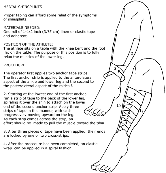 Living Active Fitness Fear Friday Shin Splints & Hot 100