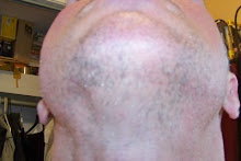 Beard hair under chin