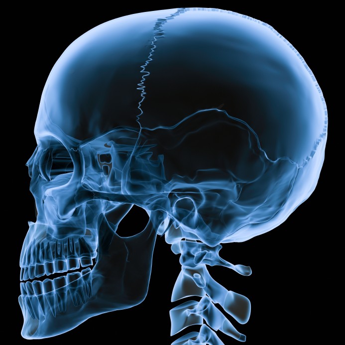 Skull+X+ray+human.jpg