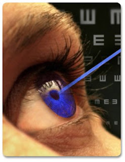 cirugia ocular laser refractiva