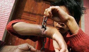 Las cadenas se integran en la carne de un hombre