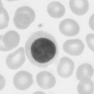 lymphocyte-01a.jpeg