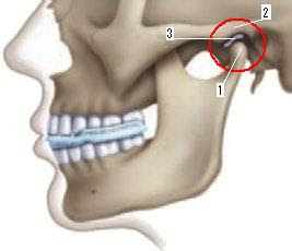 Síntesis de 20+ artículos: como curar el crujido de mandíbula [actualizado recientemente]