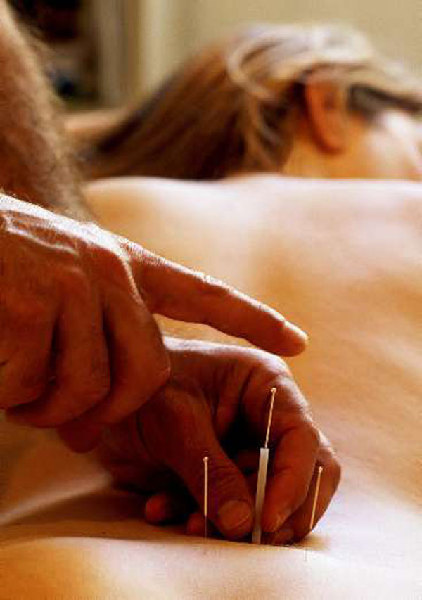 [akupunktur_754.jpg]