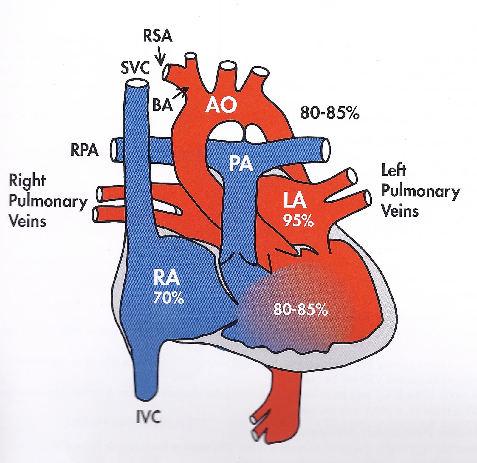 синдром гипоплазии левого желудочка. трехкамерное сердце с одним общим желудочком. гипоплазия левых отделов сердца. трехкамерное сердце с одним общим желудочком. гемодинамика при врожденных пороках сердца схема.