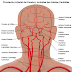 Derrame cerebral (accidente cerebro vascular o apoplejía)