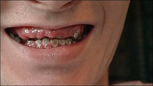 rotten-teeth-9.jpg