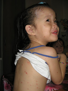 Are Chicken Pox Contagious To Dogs