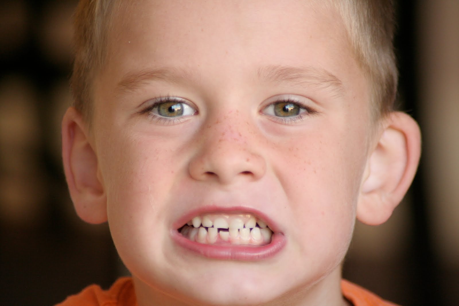 Taysoms In The News Loose Tooth