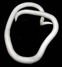 [Ascaris_lumbricoides.jpg]