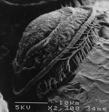 [April3_Trichodina.jpg]