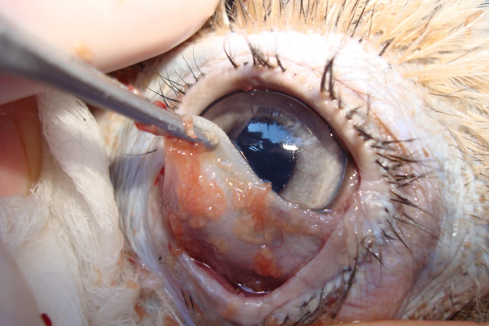 parasite in human eye