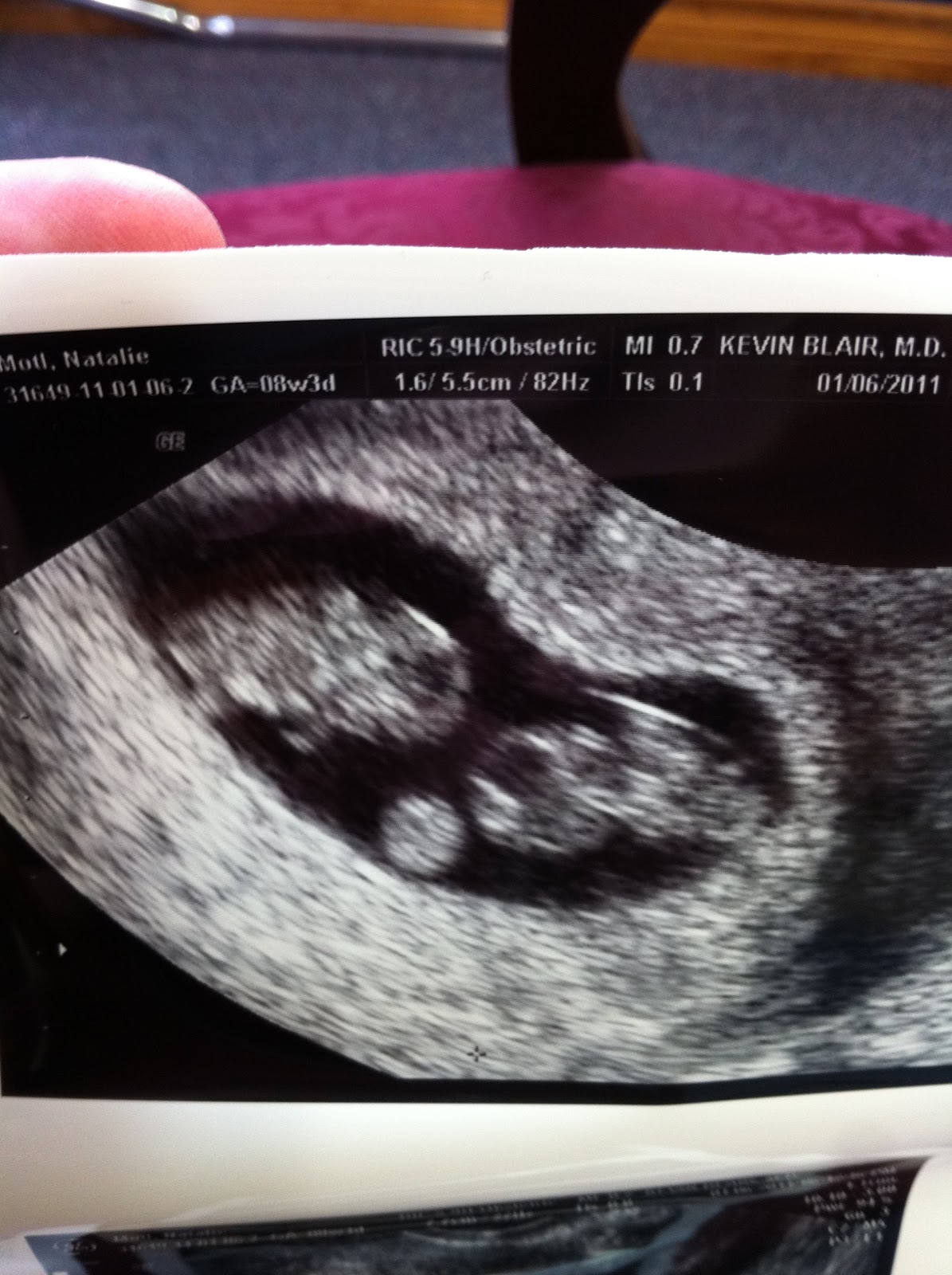 Mud Lace And Grace More Twins and Ultrasounds!!!