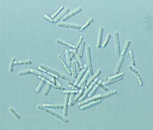 Microbiology Lactobacillus