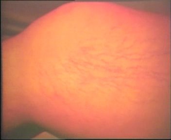 varis hakkinda bilgiler corek otu