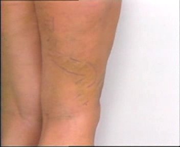 varis hakkinda bilgiler corek otu