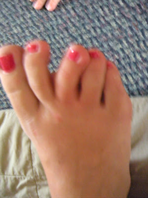 toe hitting top of shoe